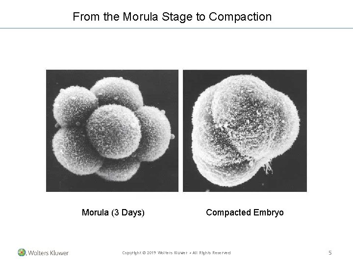 From the Morula Stage to Compaction Morula (3 Days) Compacted Embryo Copyright © 2019 From the Morula Stage to Compaction Morula (3 Days) Compacted Embryo Copyright © 2019