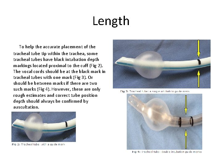 Length To help the accurate placement of the tracheal tube tip within the trachea,