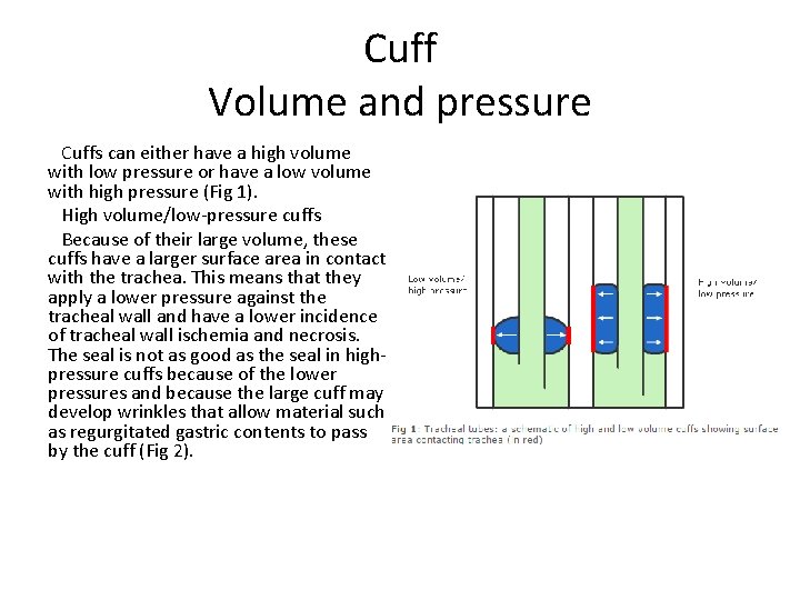 Cuff Volume and pressure Cuffs can either have a high volume with low pressure