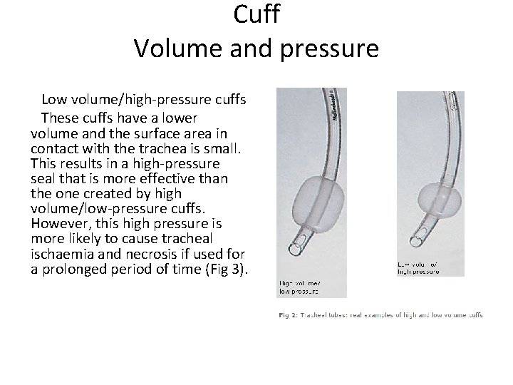 Cuff Volume and pressure Low volume/high-pressure cuffs These cuffs have a lower volume and