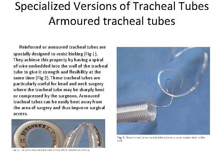 Specialized Versions of Tracheal Tubes Armoured tracheal tubes Reinforced or armoured tracheal tubes are
