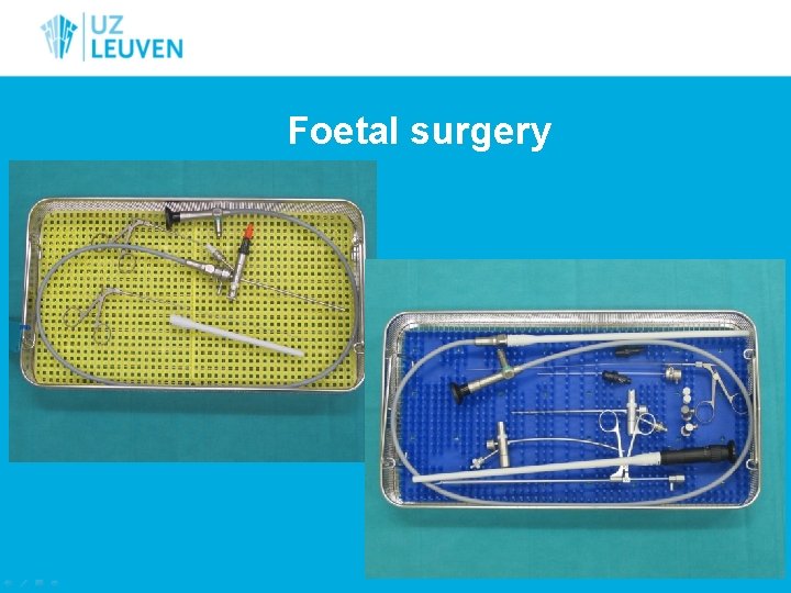 Foetal surgery 