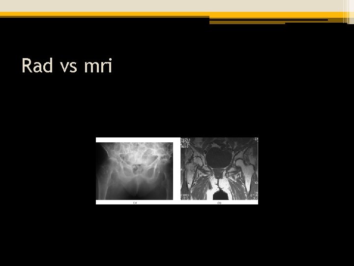 Rad vs mri 