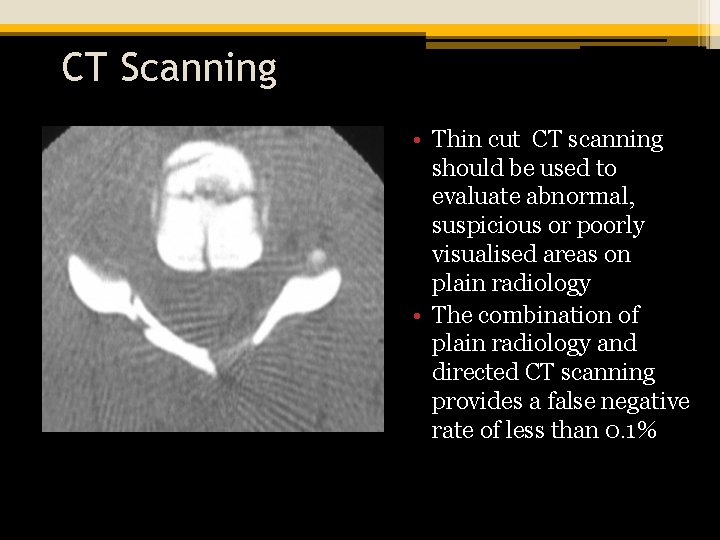 CT Scanning • Thin cut CT scanning should be used to evaluate abnormal, suspicious