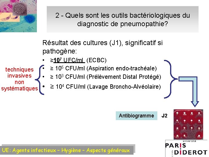2 - Quels sont les outils bactériologiques du diagnostic de pneumopathie? Résultat des cultures