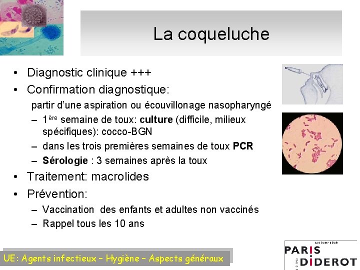 La coqueluche • Diagnostic clinique +++ • Confirmation diagnostique: partir d’une aspiration ou écouvillonage