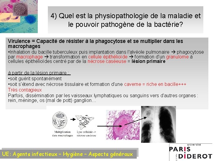 4) Quel est la physiopathologie de la maladie et le pouvoir pathogène de la