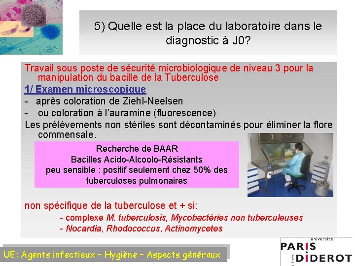 5) Quelle est la place du laboratoire dans le diagnostic à J 0? Travail