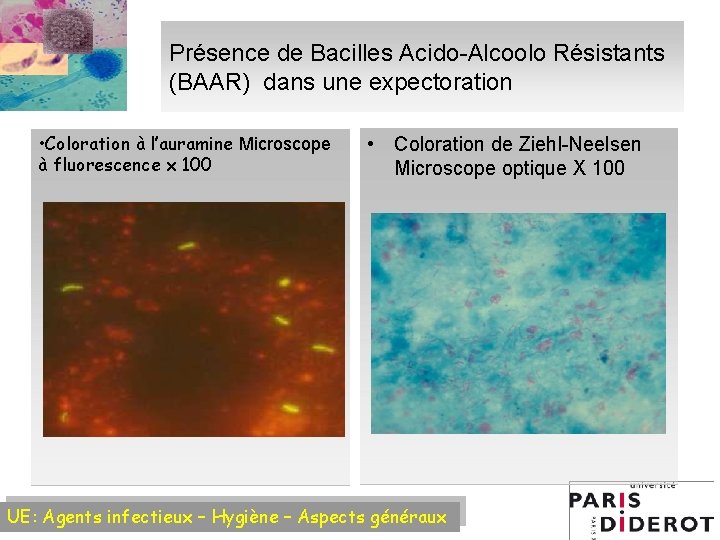 Présence de Bacilles Acido-Alcoolo Résistants (BAAR) dans une expectoration • Coloration à l’auramine Microscope