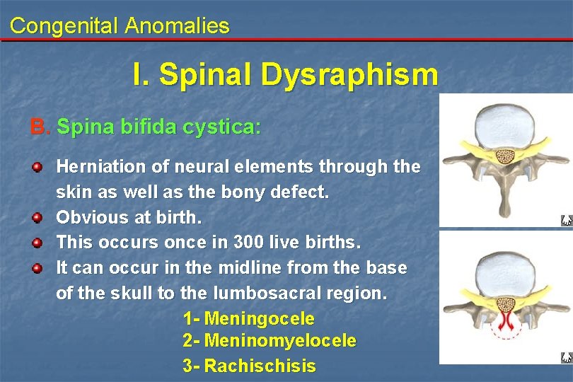Congenital Anomalies I. Spinal Dysraphism B. Spina bifida cystica: Herniation of neural elements through Congenital Anomalies I. Spinal Dysraphism B. Spina bifida cystica: Herniation of neural elements through