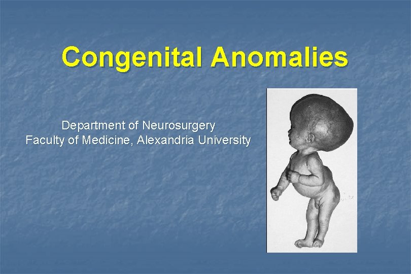 Congenital Anomalies Department of Neurosurgery Faculty of Medicine, Alexandria University 