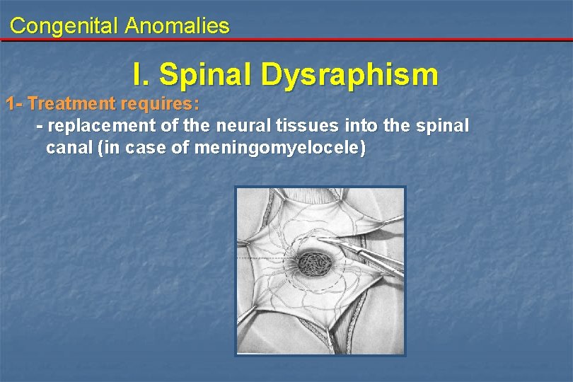 Congenital Anomalies I. Spinal Dysraphism 1 - Treatment requires: - replacement of the neural