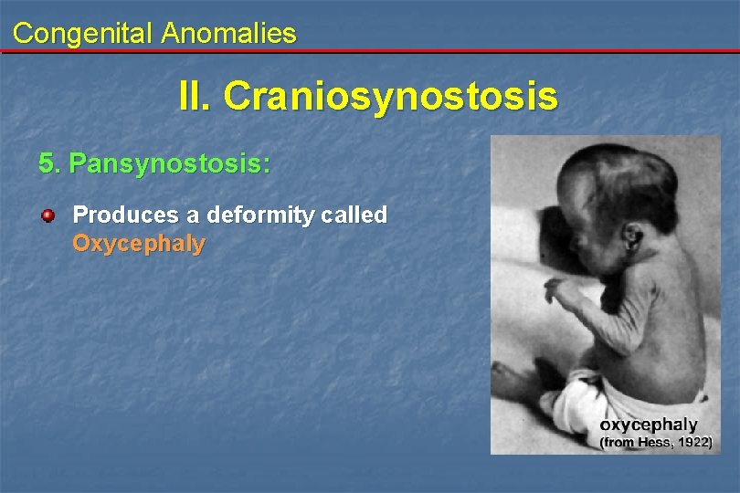 Congenital Anomalies II. Craniosynostosis 5. Pansynostosis: Produces a deformity called Oxycephaly 