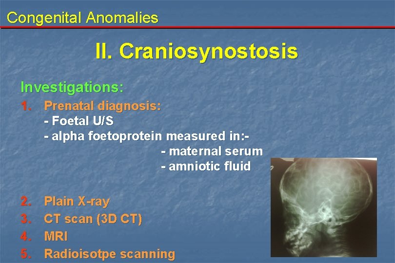 Congenital Anomalies II. Craniosynostosis Investigations: 1. Prenatal diagnosis: - Foetal U/S - alpha foetoprotein Congenital Anomalies II. Craniosynostosis Investigations: 1. Prenatal diagnosis: - Foetal U/S - alpha foetoprotein
