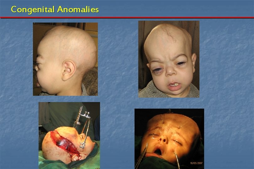 Congenital Anomalies 