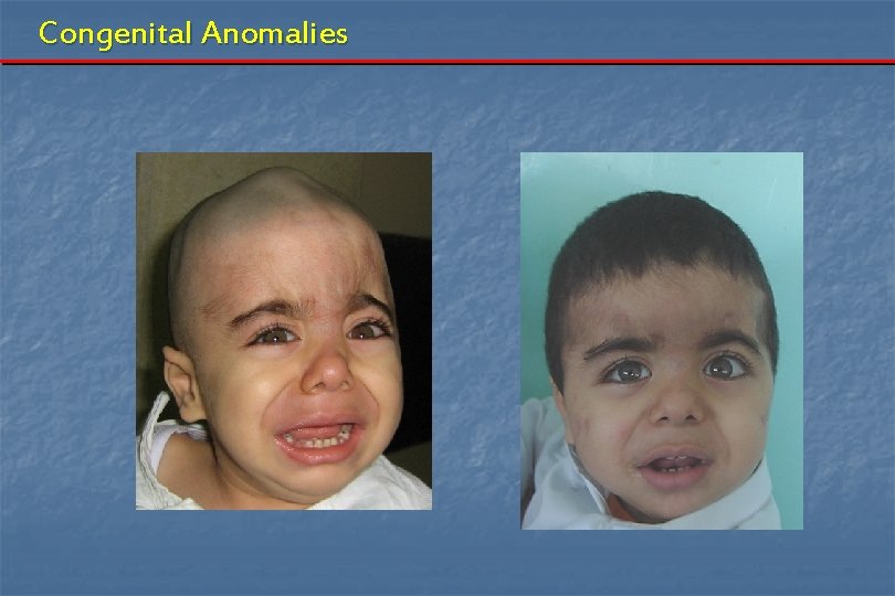 Congenital Anomalies 