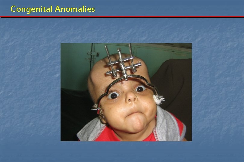 Congenital Anomalies Congenital Anomalies