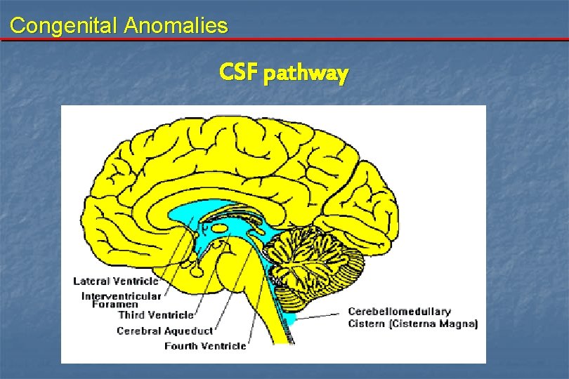 Congenital Anomalies CSF pathway 