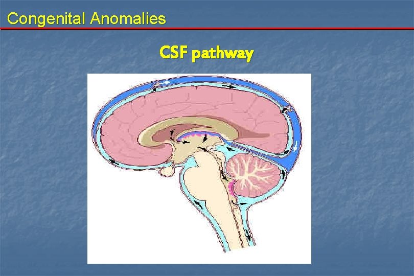 Congenital Anomalies CSF pathway 