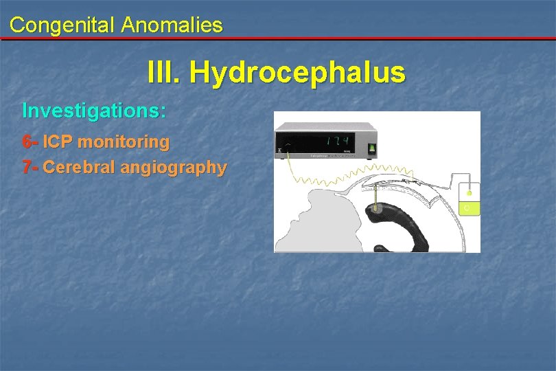 Congenital Anomalies III. Hydrocephalus Investigations: 6 - ICP monitoring 7 - Cerebral angiography Congenital Anomalies III. Hydrocephalus Investigations: 6 - ICP monitoring 7 - Cerebral angiography