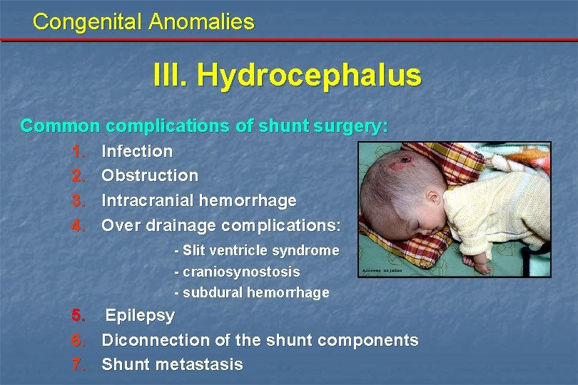 Congenital Anomalies III. Hydrocephalus Common complications of shunt surgery: 1. 2. 3. 4. Infection Congenital Anomalies III. Hydrocephalus Common complications of shunt surgery: 1. 2. 3. 4. Infection