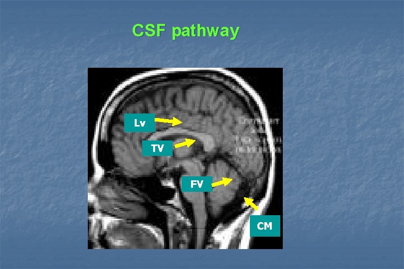 CSF pathway Lv TV FV CM 