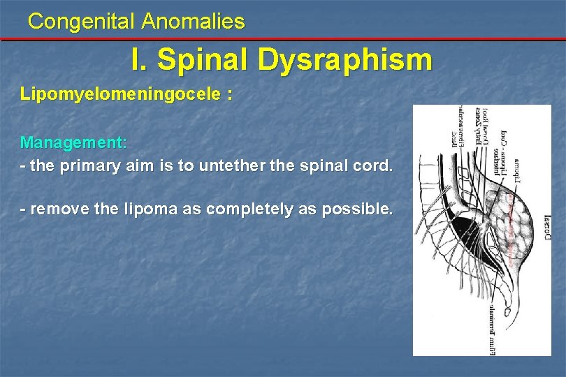 Congenital Anomalies I. Spinal Dysraphism Lipomyelomeningocele : Management: - the primary aim is to