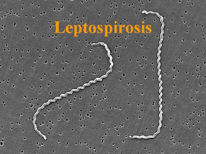 Leptospirosis 26 