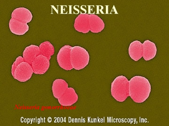 NEISSERIA Neisseria gonorrhoeae 30 