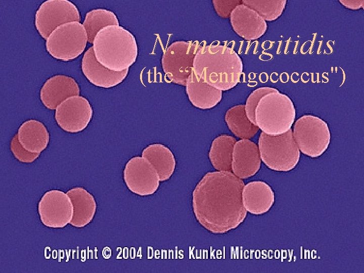 N. meningitidis (the “Meningococcus") 39 