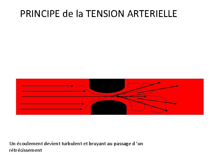 PRINCIPE de la TENSION ARTERIELLE Un écoulement devient turbulent et bruyant au passage d