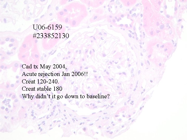 U 06 -6159 #233852130 Cad tx May 2004, Acute rejection Jan 2006!! Creat 120