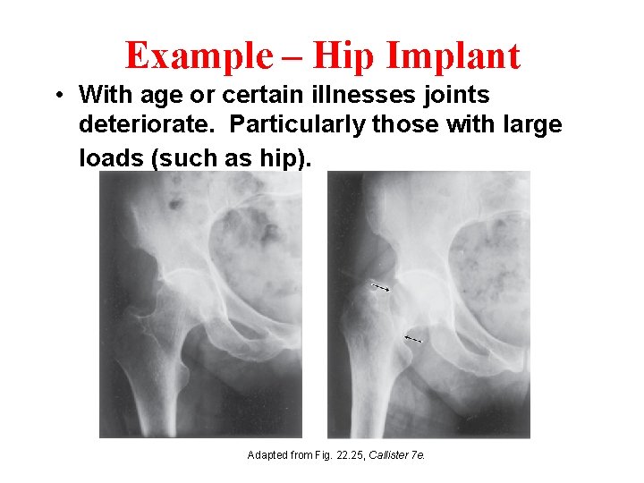 Example – Hip Implant • With age or certain illnesses joints deteriorate. Particularly those