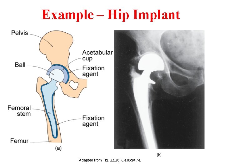 Example – Hip Implant Adapted from Fig. 22. 26, Callister 7 e. 