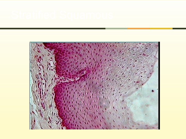 Stratified Squamous 