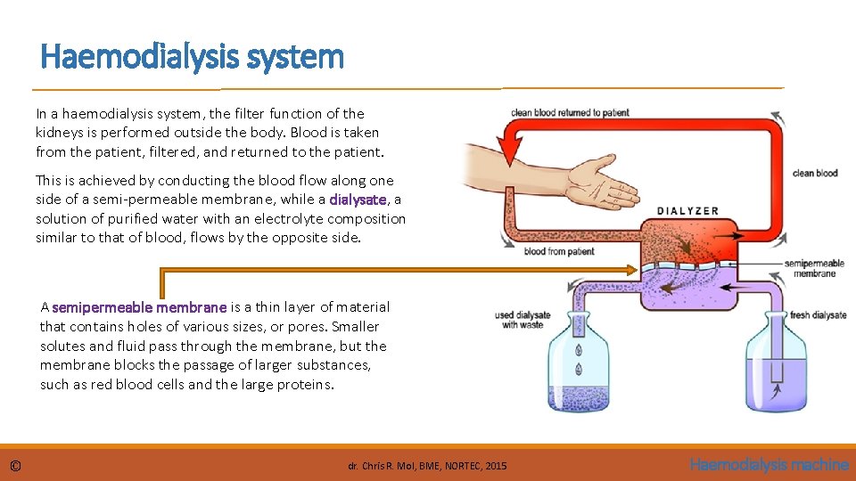 Haemodialysis system In a haemodialysis system, the filter function of the kidneys is performed