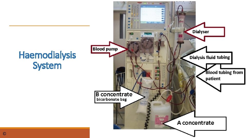 Haemodialysis System © dr. Chris R. Mol, BME, NORTEC, 2015 Haemodialysis machine 