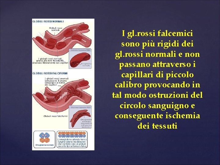 I gl. rossi falcemici sono più rigidi dei gl. rossi normali e non passano