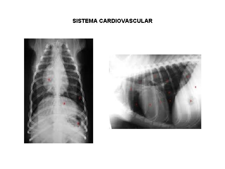 SISTEMA CARDIOVASCULAR 