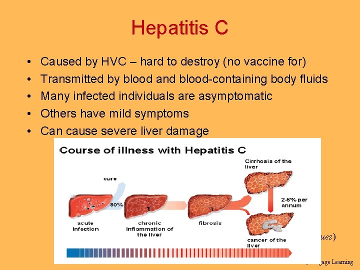 Hepatitis C • • • Caused by HVC – hard to destroy (no vaccine