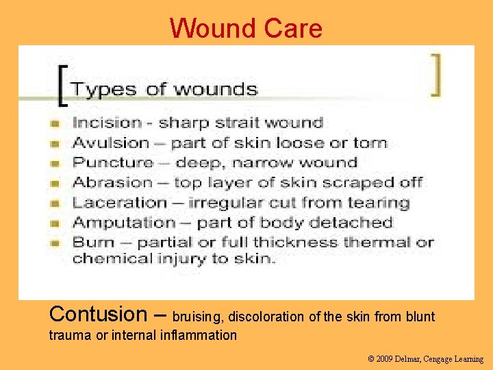 Wound Care Contusion – bruising, discoloration of the skin from blunt trauma or internal