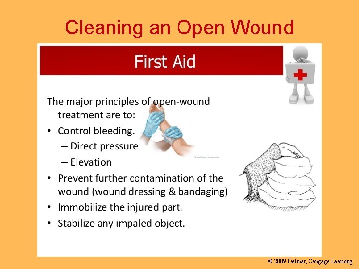 Cleaning an Open Wound © 2009 Delmar, Cengage Learning 