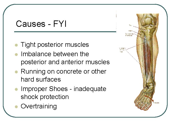 Causes - FYI l l l Tight posterior muscles Imbalance between the posterior and Causes - FYI l l l Tight posterior muscles Imbalance between the posterior and