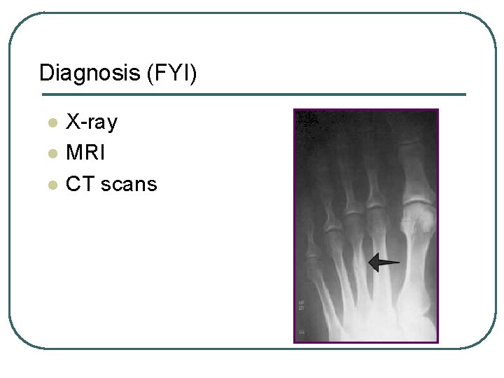 Diagnosis (FYI) l l l X-ray MRI CT scans Diagnosis (FYI) l l l X-ray MRI CT scans