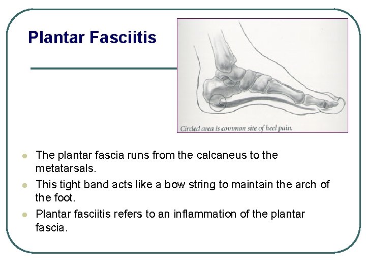 Plantar Fasciitis l l l The plantar fascia runs from the calcaneus to the Plantar Fasciitis l l l The plantar fascia runs from the calcaneus to the