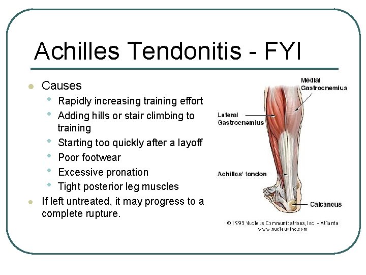 Achilles Tendonitis - FYI l l Causes • • Rapidly increasing training effort Adding Achilles Tendonitis - FYI l l Causes • • Rapidly increasing training effort Adding