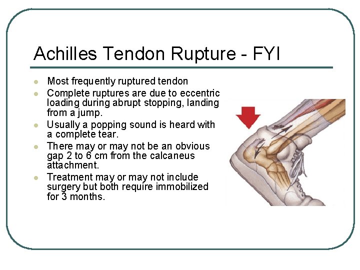 Achilles Tendon Rupture - FYI l l l Most frequently ruptured tendon Complete ruptures Achilles Tendon Rupture - FYI l l l Most frequently ruptured tendon Complete ruptures