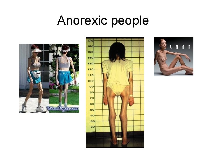 Anorexic people 