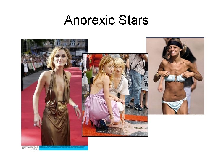 Anorexic Stars 