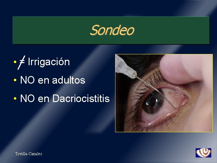 Sondeo • = Irrigación • NO en adultos • NO en Dacriocistitis Tovilla-Canales 